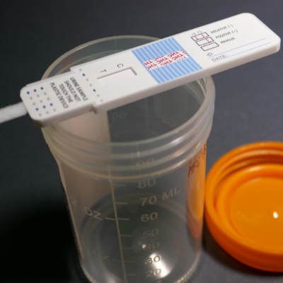 découvrez l’importance du dépistage du cannabis : méthodes, fiabilité des tests, durée de détection et conseils pour une prévention efficace. toutes les informations essentielles sur le dépistage du cannabis.